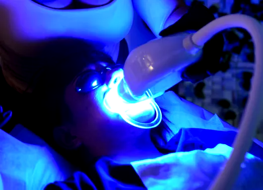 Advanced Teeth Whitening