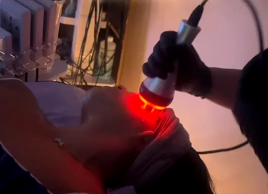 R.F. Facial