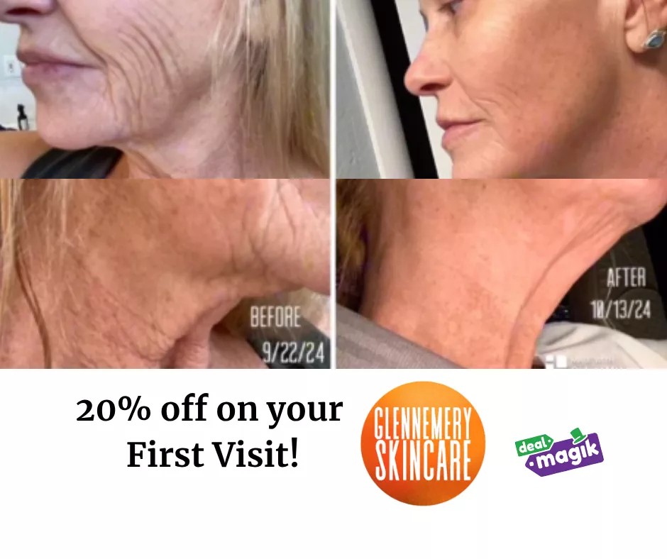 Glow, Lift & Rejuvenate – Your Skin Will Thank You! ✨