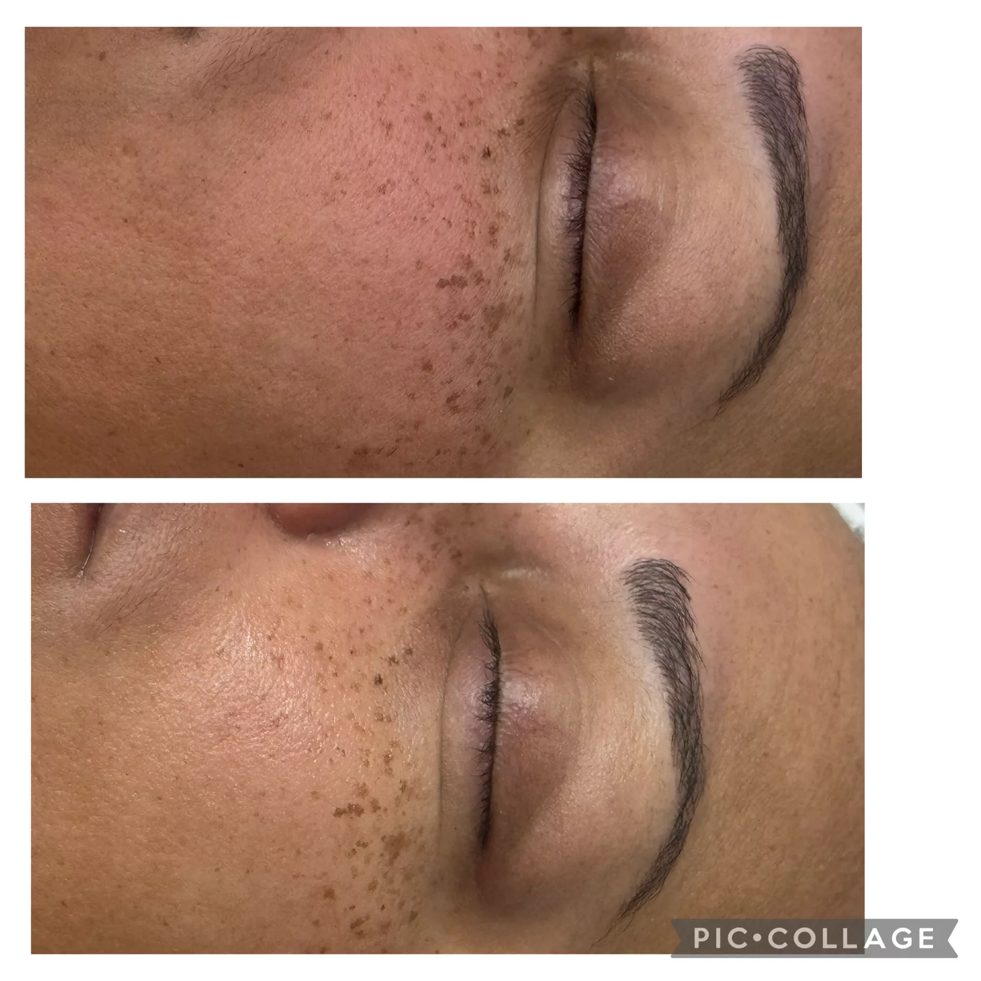 Radiance Facial